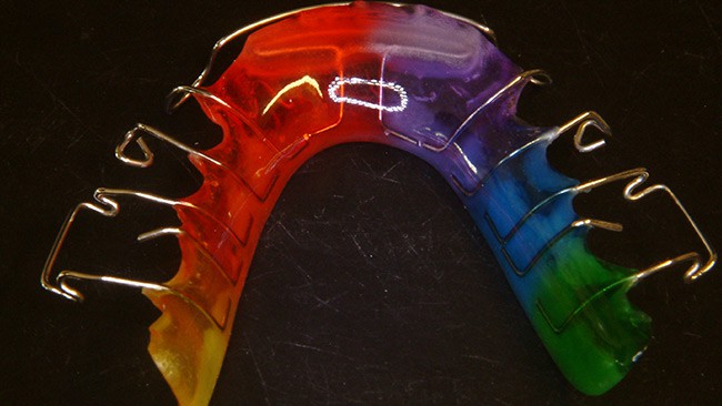 header_06b KFO-Prothetik